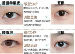 西京医院割双眼皮专家有哪些？能清楚看到谁做得好及手术价格！
