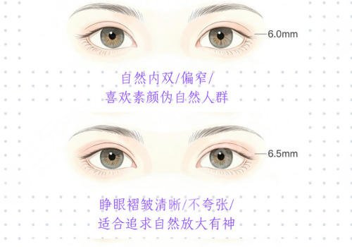 双眼皮