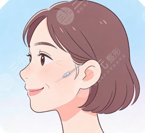 面部填充