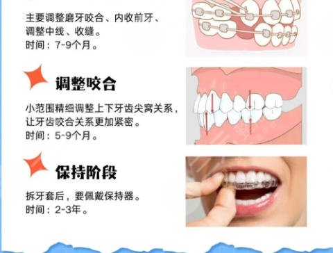 牙齿矫正
