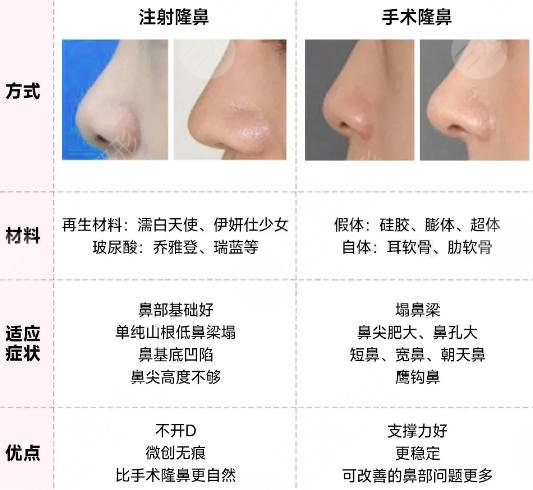 隆鼻
