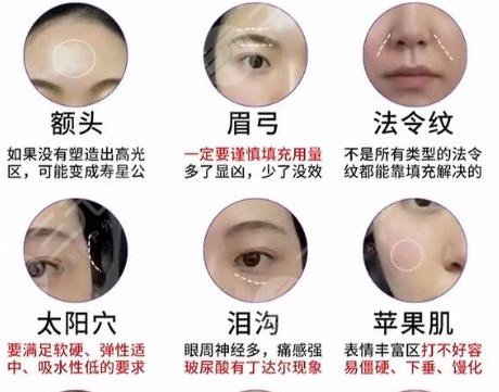 面部填充