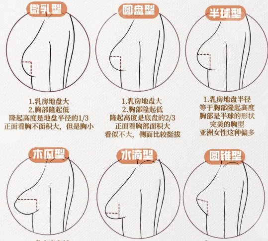 隆胸
