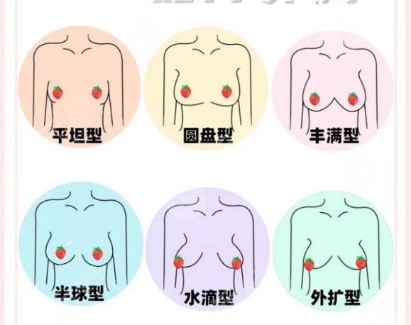 隆胸