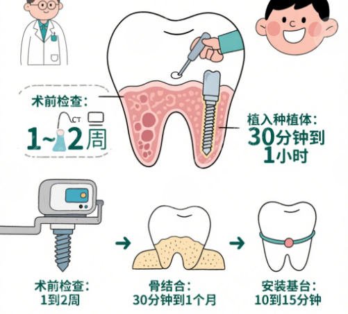 牙齿种植