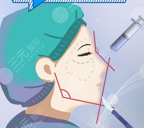 隆鼻