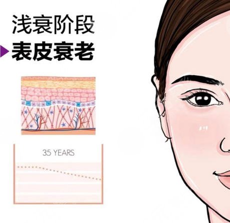 面部提升