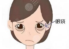 滨州去眼袋医院怎么样？热门医院、案例这都有，速看
