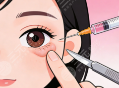 西京医院整形科做眼袋价格｜26年10月收费信息怎么看？眼袋手术花费拆开说