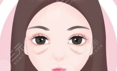 西安人民医院祛眼袋多少钱？眼袋手术收费有哪些部分，预算如何计算
