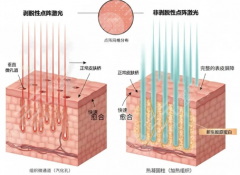 八大处点阵激光医生排名：2026年新版整理！不同医生擅长方向有何区别？