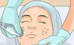 天津第一中心医院祛斑价格：做一次激光要花多少？不同色斑的治疗费用差在哪