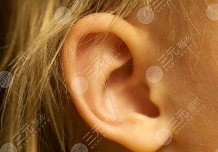 耳缺失再造手术技术成熟吗？做手术有哪些注意事项？快来学习！