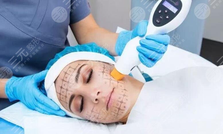 先做超声提拉还是先做热玛吉比较好？专业人士告诉你怎么选！