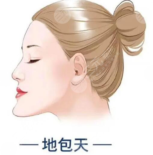 地包天是怎么造成的后果？地包天怎么改良？地包天矫正案例对比照