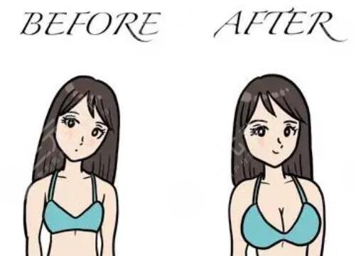 毛面假体和光面假体哪个好？隆胸假体型号分析_假体隆胸术前术后注意事项