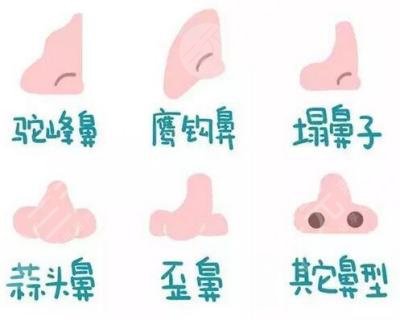 上海歪鼻子矫正手术多少钱？