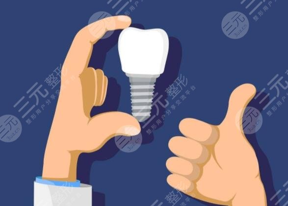 种植牙医生不说但你需要知道的！种植牙多少钱一颗2021（2022通用）价格表