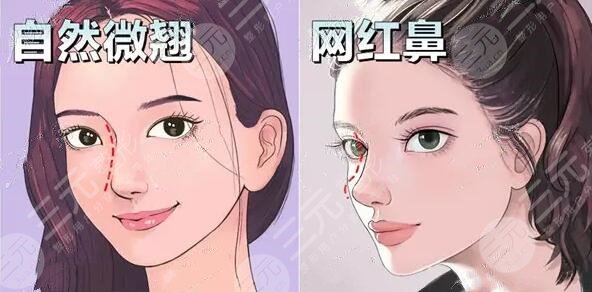 广州李琳医生做鼻子案例:隆鼻恢复45天果,闺蜜直呼“求安利”! 广州李琳医生做鼻子案例:隆鼻恢复45天果,闺蜜直呼“求安利”!