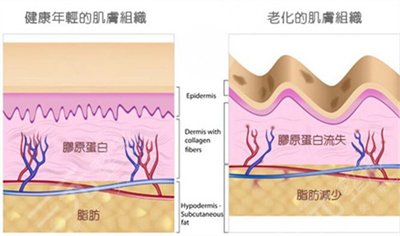 电波l皮除皱手术果好不好 电波l皮除皱手术果好不好