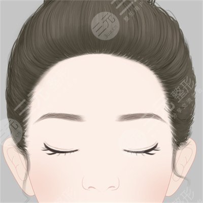 怎么去除毛孔粗大
