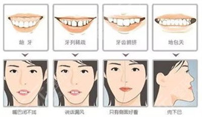 虎牙该怎么矫正