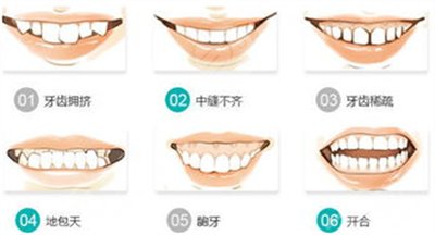 牙齿不整齐怎么办 牙齿不整齐怎么办