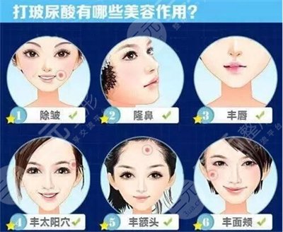 注射注射瘦脸祛除鱼尾纹怎么样 注射注射瘦脸祛除鱼尾纹怎么样