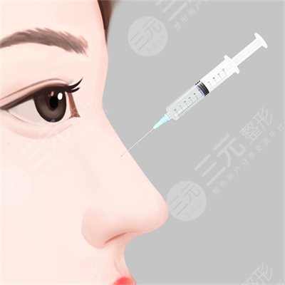 玻尿酸隆鼻会变宽吗 玻尿酸隆鼻会变宽吗