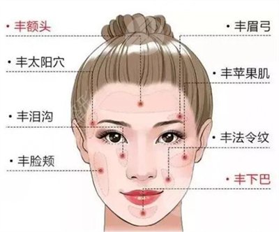 上海首尔丽格整形医院面部填充怎么样