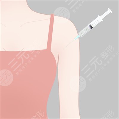 光纤吸脂瘦手臂会反弹吗 光纤吸脂瘦手臂会反弹吗