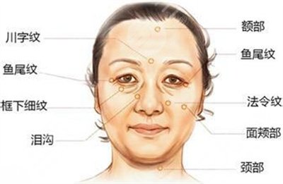 v美减龄果好不好能维持几年?术后注意事项盘点!抗衰攻略~ v美减龄果好不好能维持几年?术后注意事项盘点!抗衰攻略~