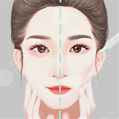 打玻尿酸后注意什么? 打玻尿酸后注意什么?