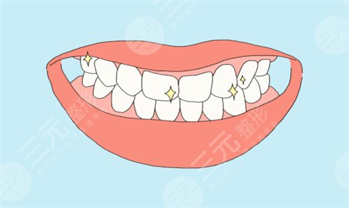 皓齿美白牙齿多少钱 皓齿美白牙齿多少钱