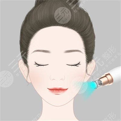 光子嫩肤对皮肤有伤害吗?真相曝光! 光子嫩肤对皮肤有伤害吗?真相曝光!