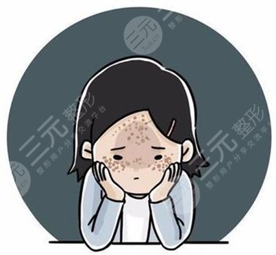 牛奶咖啡斑能去除吗 牛奶咖啡斑能去除吗