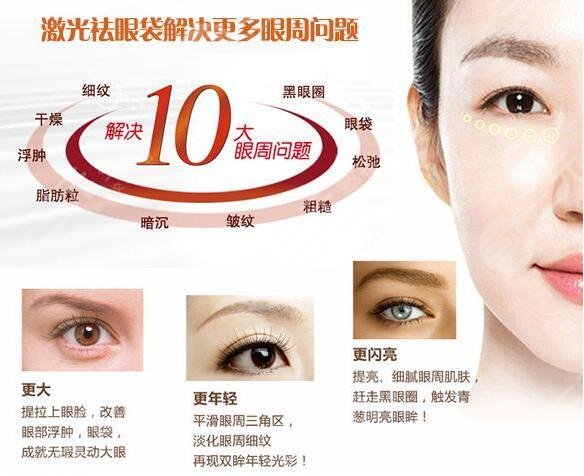 激光去眼袋要多久能恢复 激光去眼袋要多久能恢复