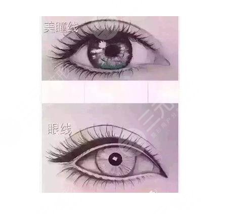 纹眼线多久能恢复