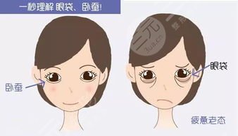 卧蚕眼手术方法是什么 卧蚕眼手术方法是什么