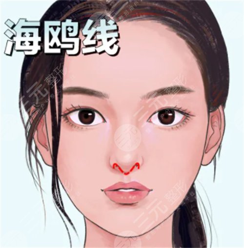 北京韩式隆鼻价格需要多少钱 北京韩式隆鼻价格需要多少钱