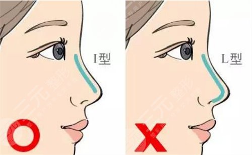 怎么垫高鼻梁?垫高鼻梁的方法有哪些 怎么垫高鼻梁?垫高鼻梁的方法有哪些