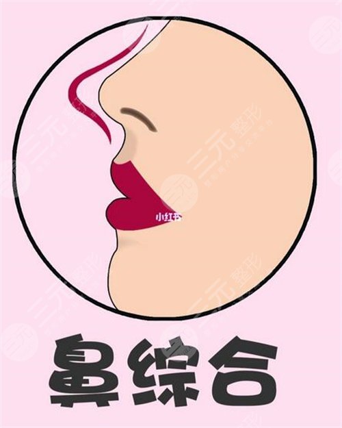 隆鼻整形价格市场价多少?隆鼻整形对比照图片 隆鼻整形价格市场价多少?隆鼻整形对比照图片