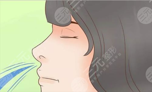 怎么隆鼻子?90小花也没躲过鼻修复之路?医生为你剖析美鼻真理! 怎么隆鼻子?90小花也没躲过鼻修复之路?医生为你剖析美鼻真理!
