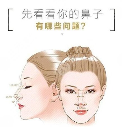 垫鼻基底可以改良法令纹吗？在韩国，它叫“贵族手术”