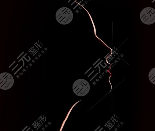 缩鼻翼对比照片,缩鼻翼手术注意事项有哪些? 缩鼻翼对比照片,缩鼻翼手术注意事项有哪些?