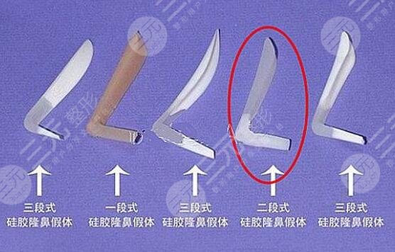 韩式仿生隆鼻好不好?