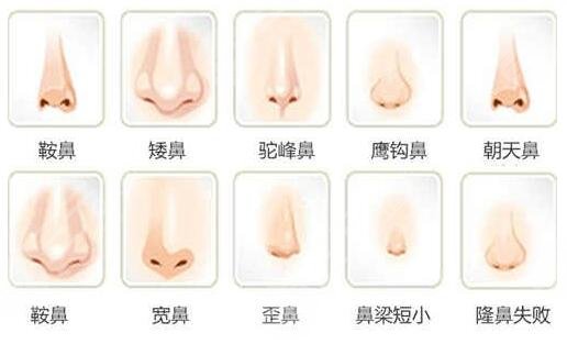 隆鼻失败修复注意事项和术后护理有哪些?