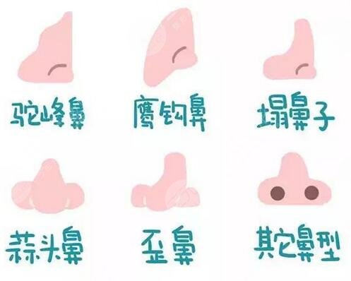 上海首尔丽格朴兴植做隆鼻整形怎么样?