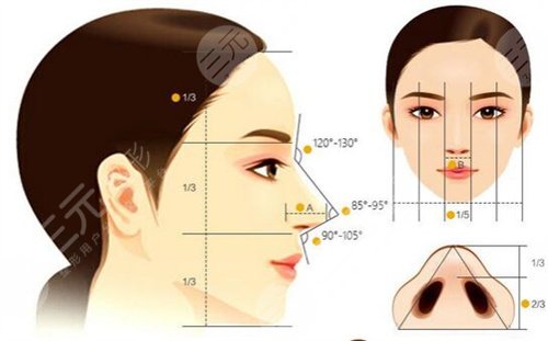 隆鼻有哪几种方法