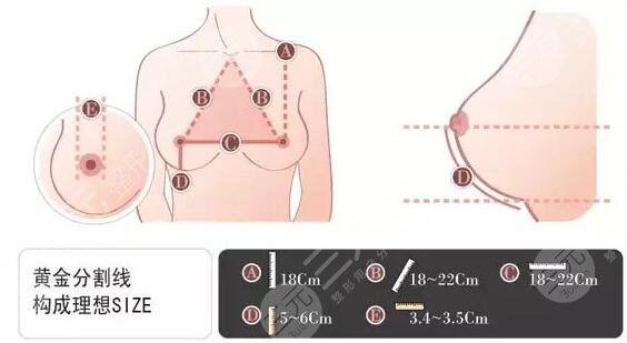 隆胸手术的并发症应该如何避免和预防?